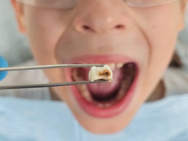 Best Emergency Orthodontic Repairs in Linden, CA